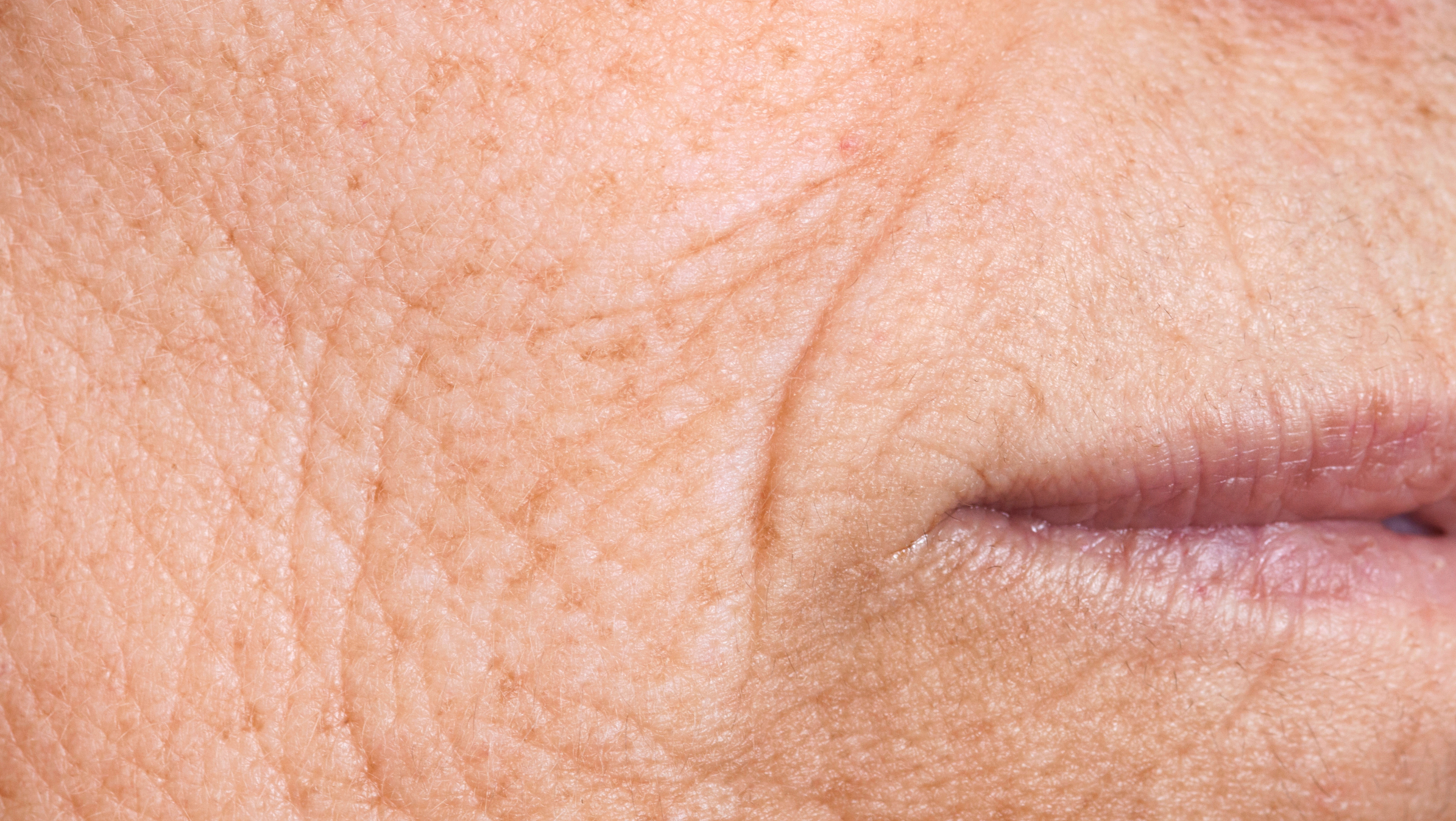 why-do-wrinkles-form-triple-solution-skincare