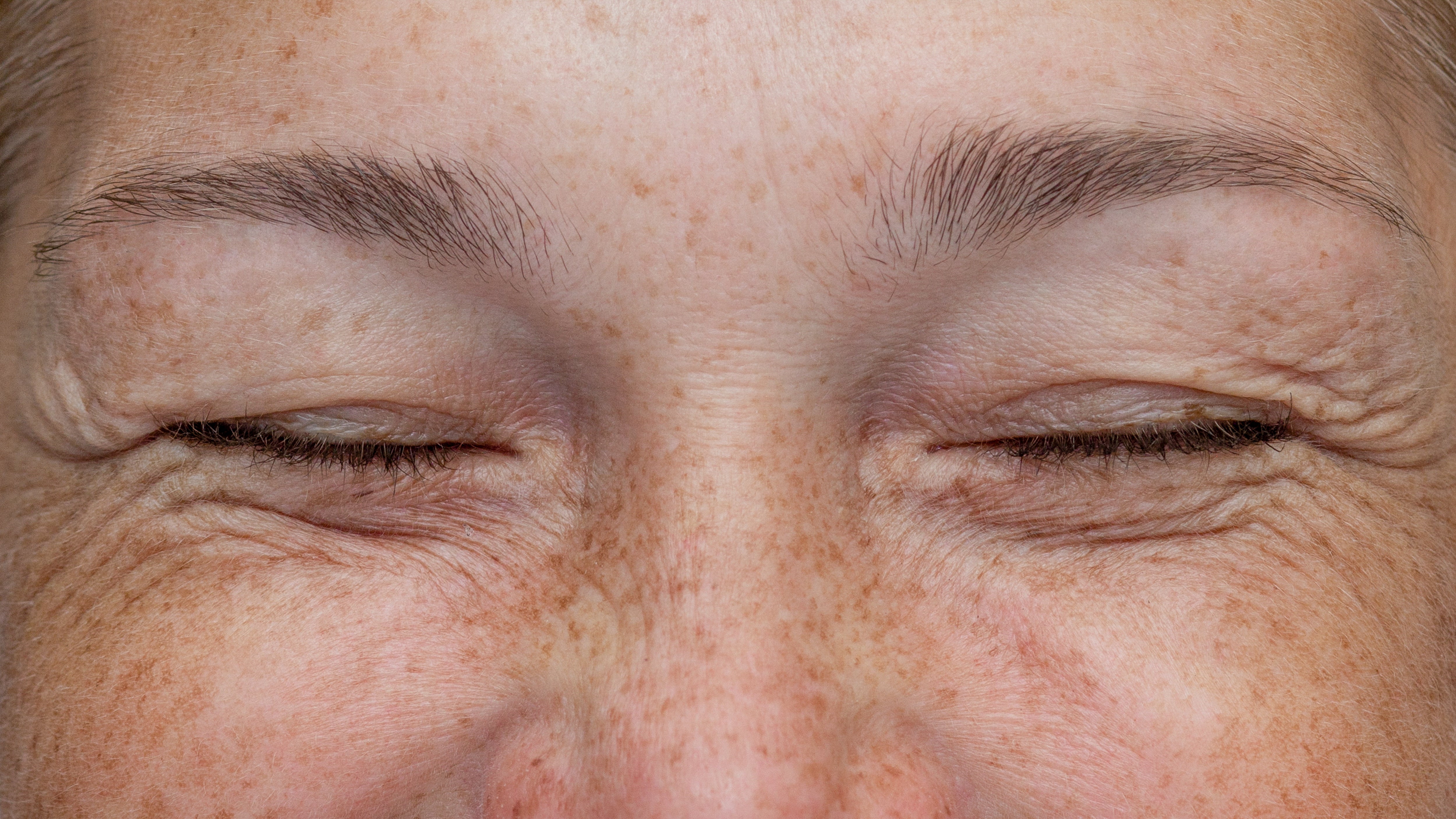 What Your Skin Loses Over Time — And Why It Matters